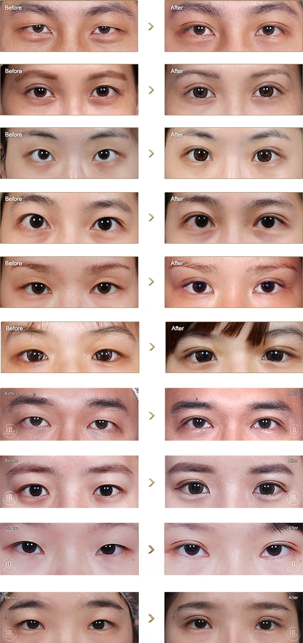 BL-eyes-new-20220708_1