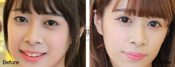 bleyes-sp11_600x231