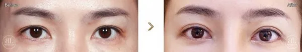 000000000-eyes-220707_600x104