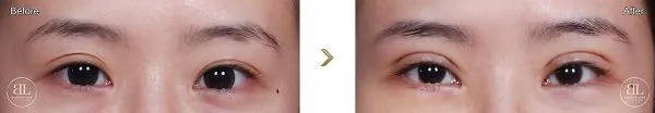 000002492-eyes-220707_600x104