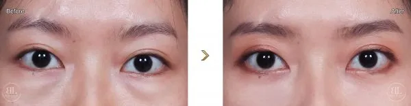 000008616-eyes-220707_600x156