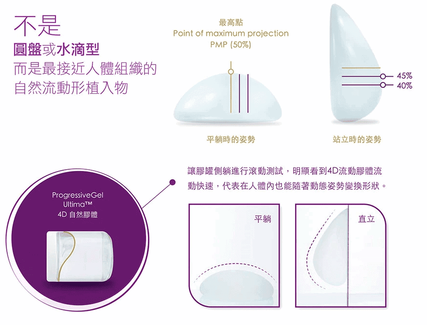 極致4D流動膠體，其中的圖表顯示了其形狀和突出百分比。顯示魔滴Joy 2.0植入物的形式和特徵的圖示。